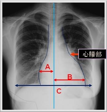 临床助理医师实践技能考试x线平片影像诊断公式及步骤