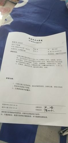 脑瘤患者病例(7)