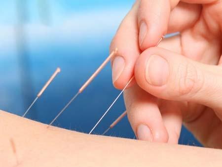 进而刺激乳房科技频道 你知道吗 > 正文          因素二:针灸丰胸