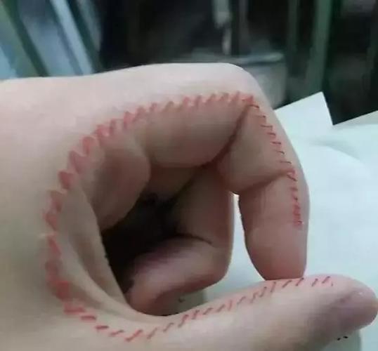少女把自虐当时尚