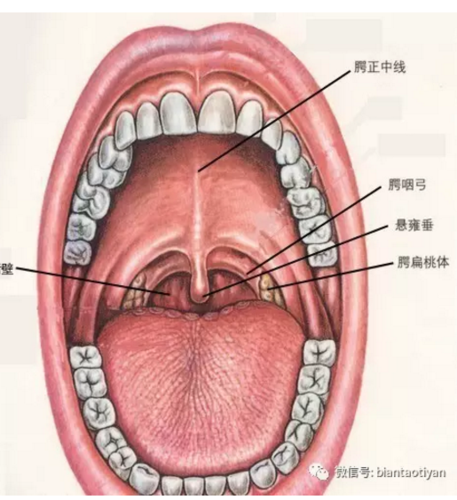 扁桃体发炎怎么办