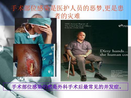 手术备皮流程管理