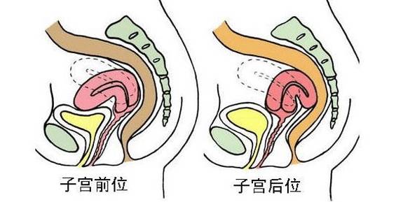 为什么会出现子宫后位?