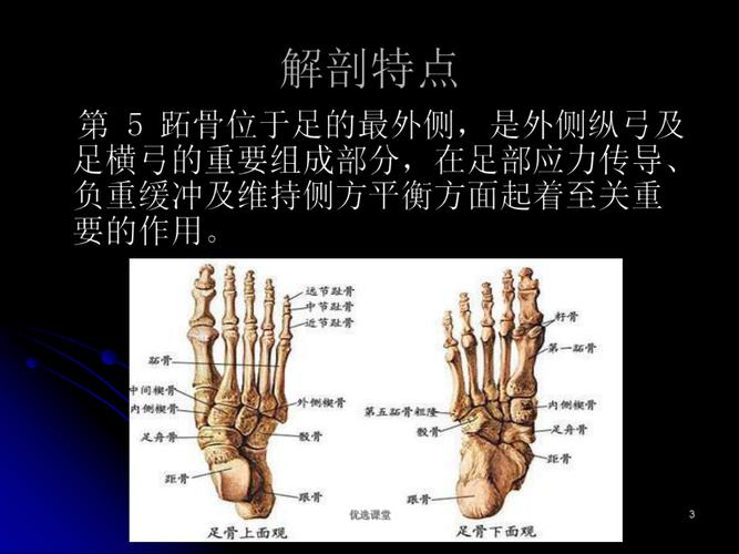第五跖骨基底部骨折的治疗讲课适用