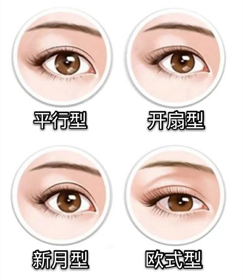 双眼皮类型科普