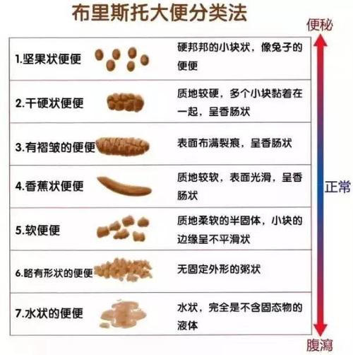 关于便便的形状,可是有专业描述的,那就是「布里斯托大便形状分类」.
