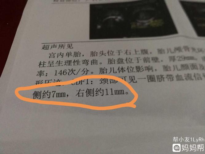怀孕35周,双肾分离7mm和11mm,正常吗?亲们