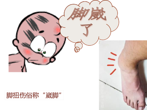 脚扭伤 幻灯片