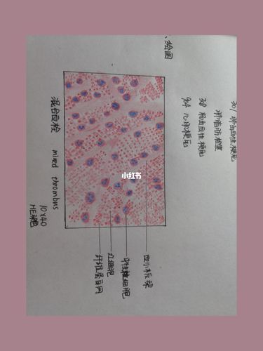混合血栓_医学生_医学生的日常_医疗健康_医疗健康其他