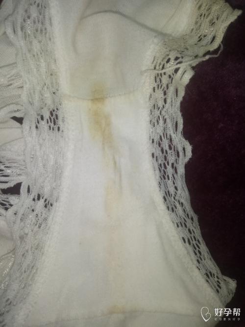 穿了一天,内裤是这样,没有异味,有黄黄的白带,咋回事,月经第11天