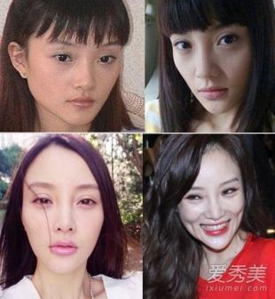 郑爽脸肿vs萧蔷脸歪,盘点那些越整越难看的女星