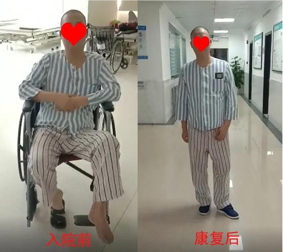 深圳中风偏瘫怎么办?康复治疗重新站起来