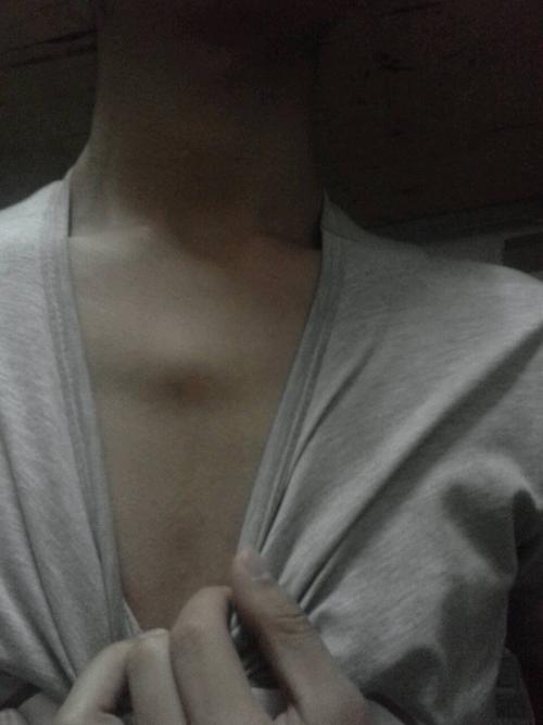 以前没发现,前两周突然看到胸前突出了一块骨头,也不疼不痒,什么症状