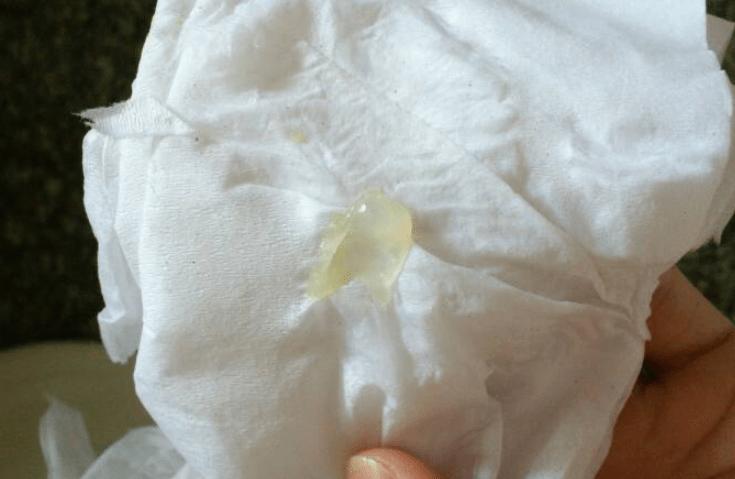 白带3种"异常",多半是hpv入侵,医生:养成3个习惯,轻松