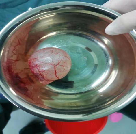 睾丸|疝气|囊肿_网易订阅