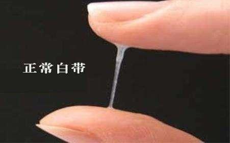 白带7种异常必须就医,宫颈癌的预警就在其中