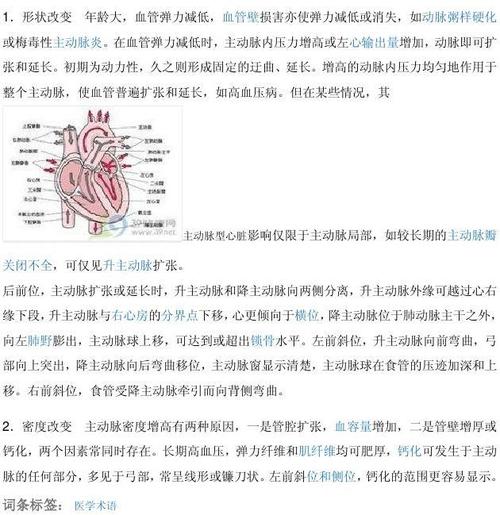 主动脉型心脏