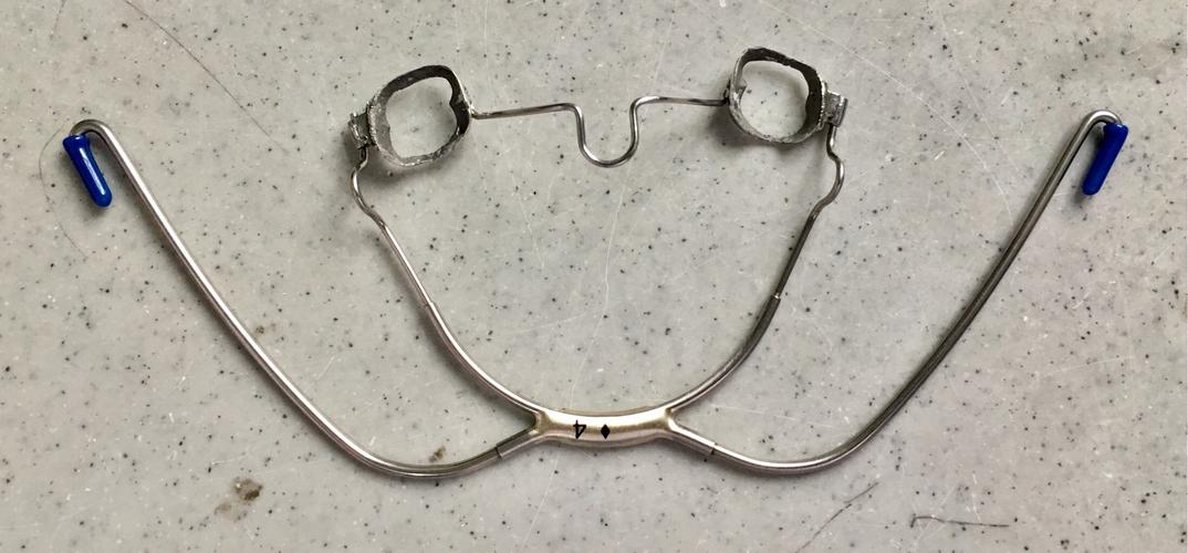 图3为模拟口外弓在口内的使用