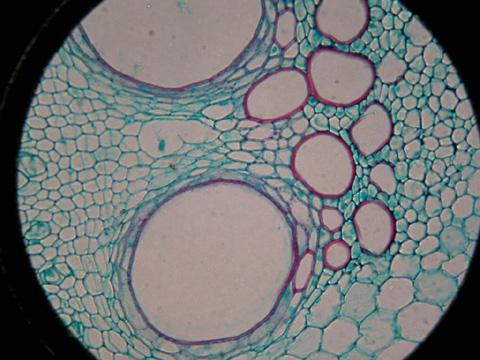 南瓜茎横切(示木质部)
