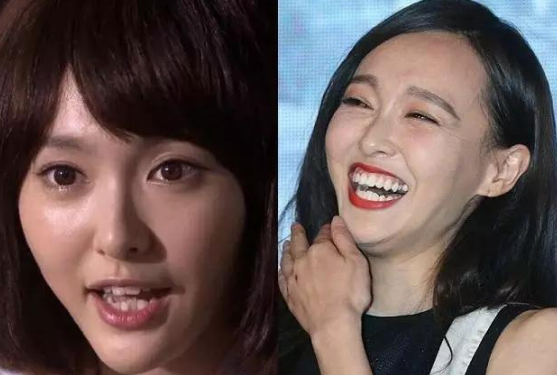 "整牙"如换头的5位女星:杨幂变瓜子脸,baby气质突变?