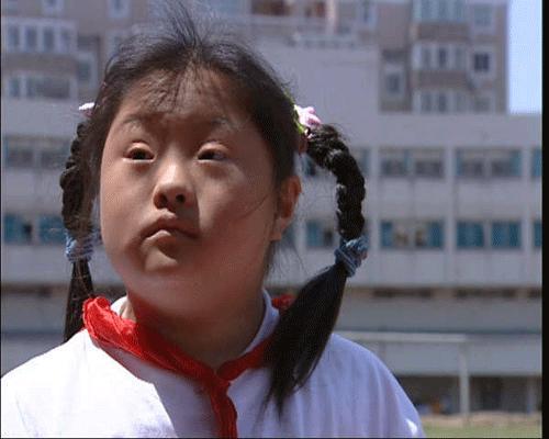 "唐氏儿"形成的原因?多半是源于父母,这2类孕妈需注意