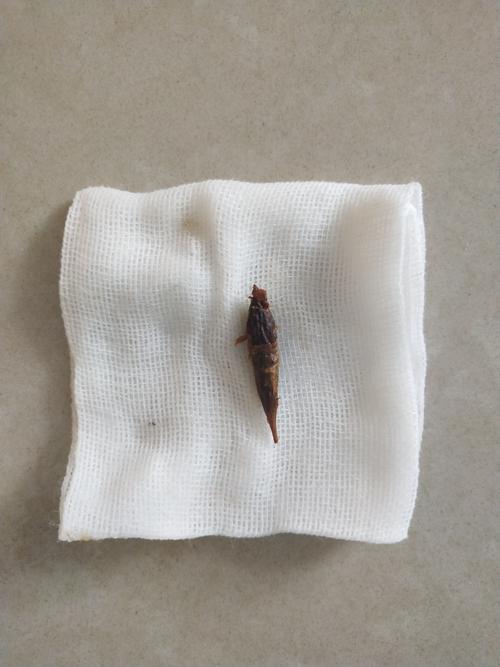 猜测是痔疮发作,匆匆赶到医院.