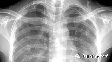 x光胸片可粗略检查心脏,主动脉,肺,胸膜,肋骨