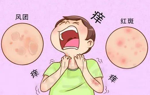 常见皮肤病荨麻疹让你痒到发狂和哪些因素有关