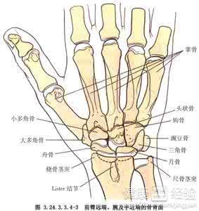手指关节融合手术是什么意思