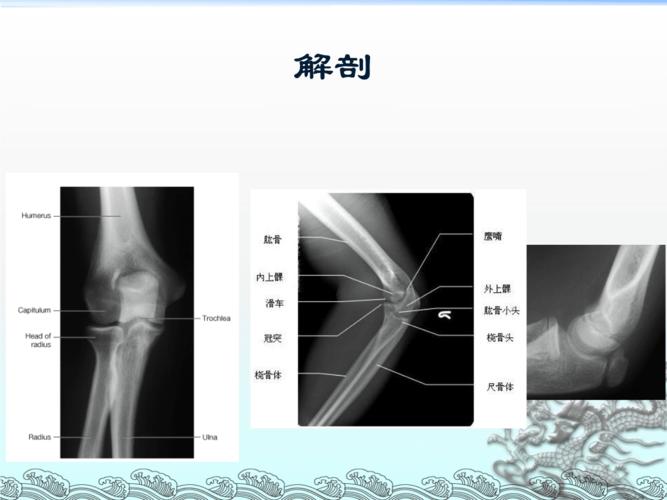 尺骨鹰嘴骨折ppt34页