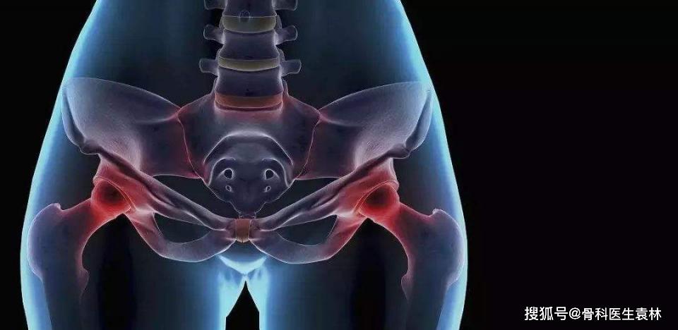 髋关节疼痛都是由哪些原因引起的?_手机搜狐网