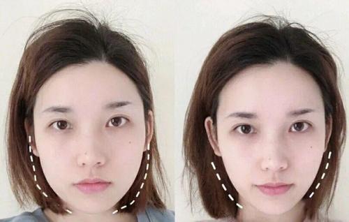 这个比瘦脸针还好用的好物,既消水肿又提拉紧致,让你秒变小v脸!