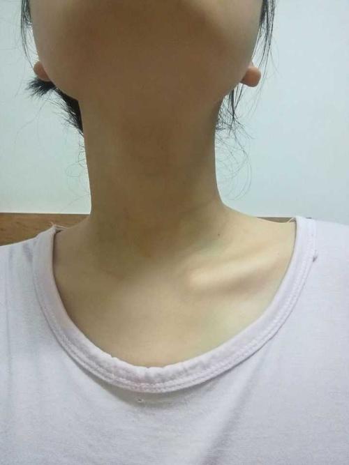 第二天 脖子没有了,手也没有了.开心