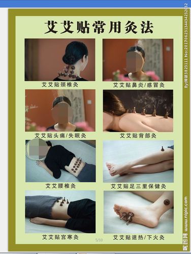 艾艾贴常用灸法图片