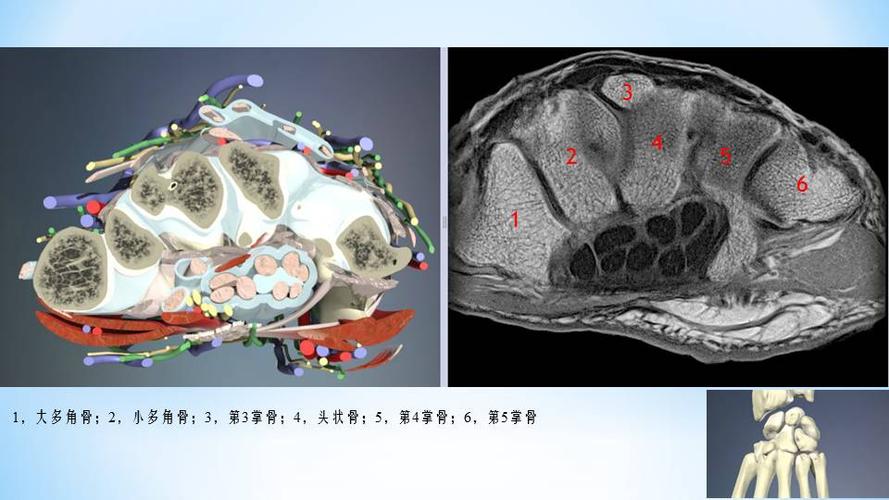 高清腕关节断层解剖图谱