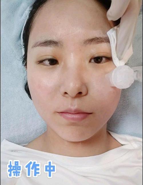 为什么你的水光针效果不如我