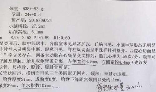 b超单上"肾盂分离",是暗示性别吗?看完就不会一知半解了