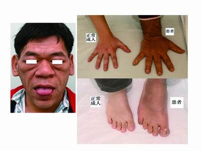 真假"胃炎"要辨清