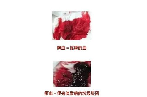 毛细血管|肾脏|淤血|血液