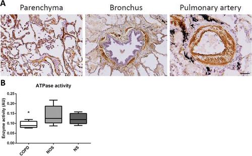 is the purinergic pathway involved in the pathology of copd?