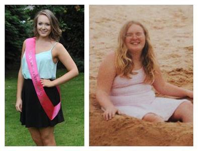 英国女孩因肥胖遭欺凌 减肥后成选美冠军