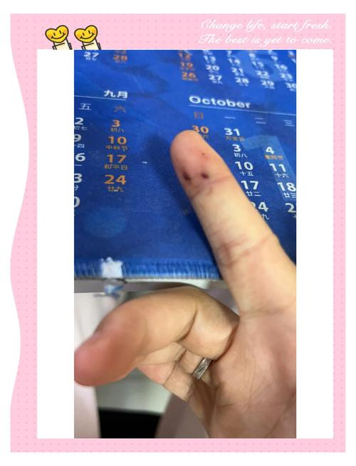 紧急处理指南 最近养了只小仓鼠,结果有一天发现它的笼子没关好,小