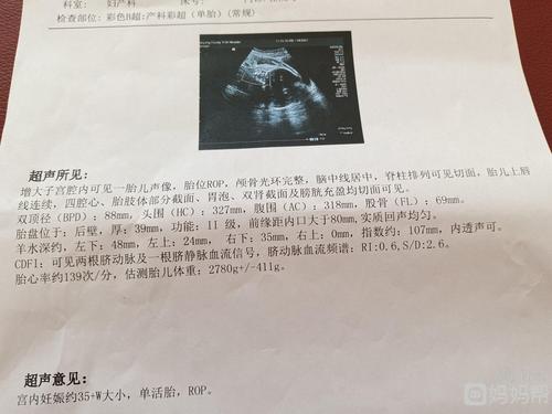 胎位rop什么意思,还能顺产吗