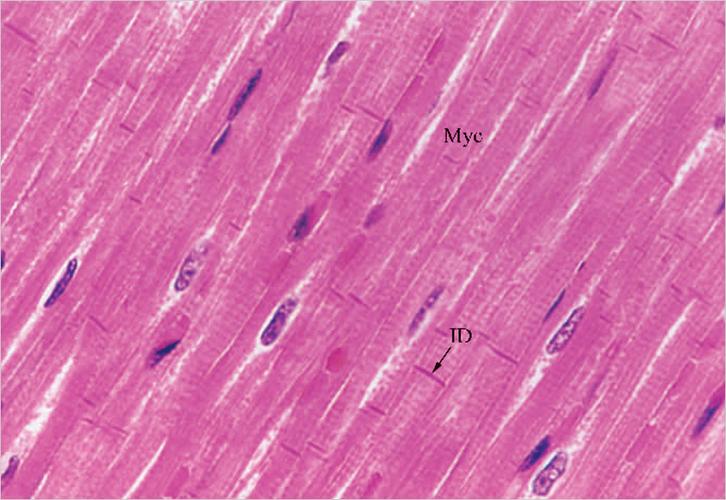 图像名称:心肌膜