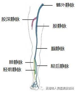 久坐不动危害大,下肢深静脉置管溶栓效果好!