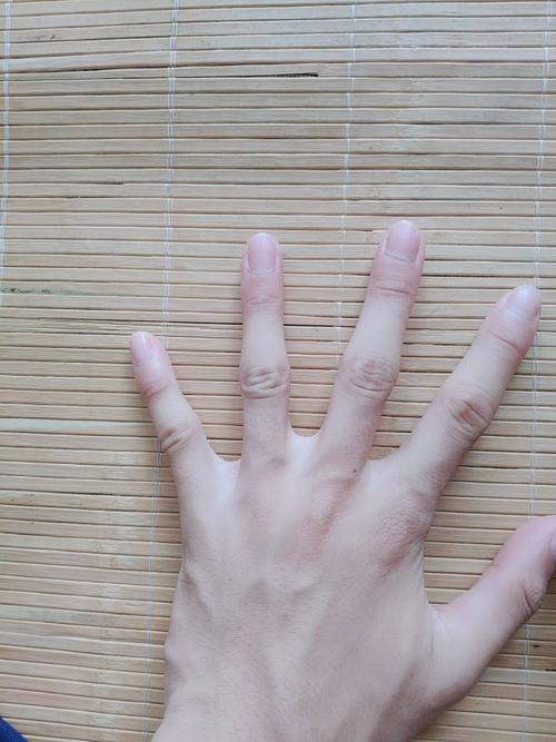 手指是不是骨质增生啊?