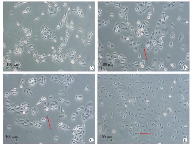 1  go对hacat细胞形态的影响 如图 2所示,光镜下观察发现低浓度( 10.