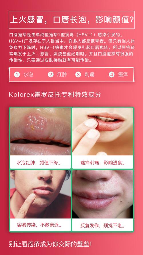 滋润修护干裂唇解决口唇疱疹