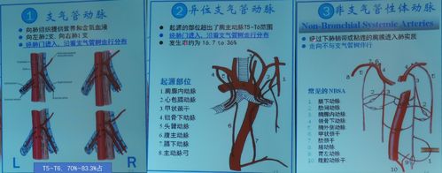 弹簧圈进行支气管动脉主干栓塞后,其侧支吻合血管及病理血管