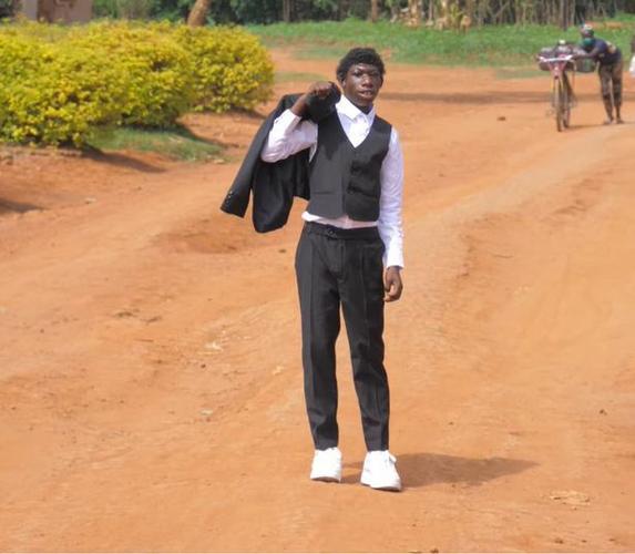 男子患小头畸形症被全村人歧视只能逃到丛林生活如今怎样了